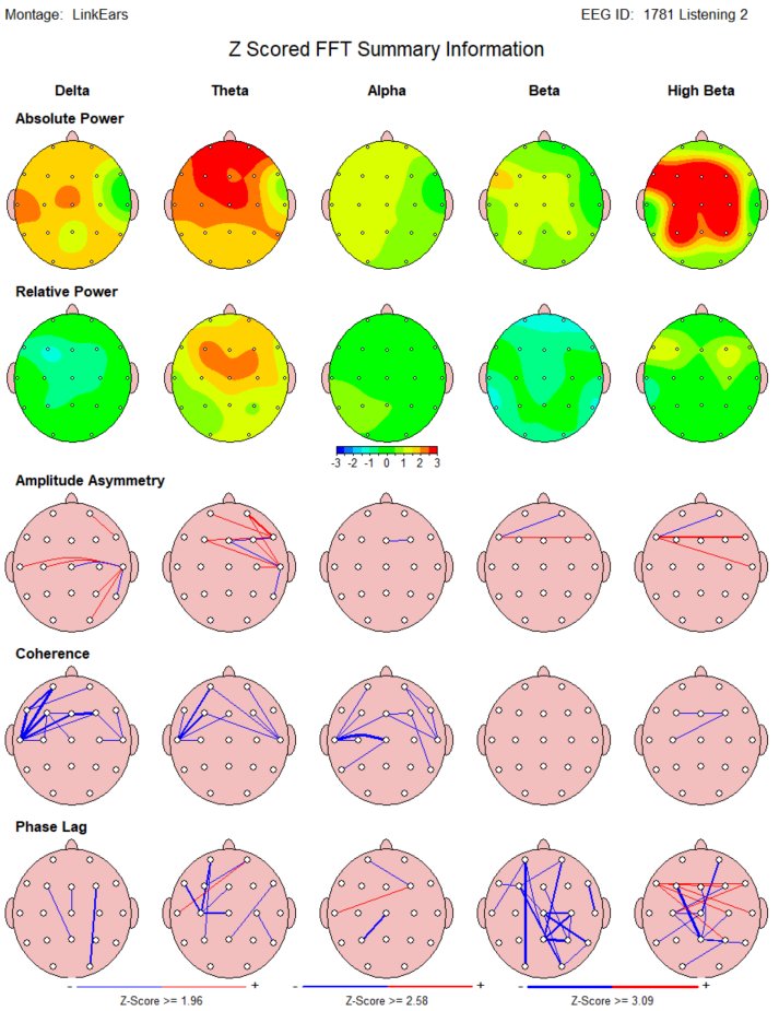 Z-scored qEEG summary maps — absolute power, relative power, coherence, phase lag